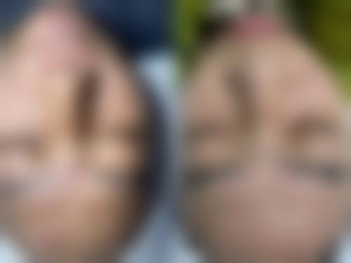 八、桂林叶氏嘉美美容整形医院真实的患者评价