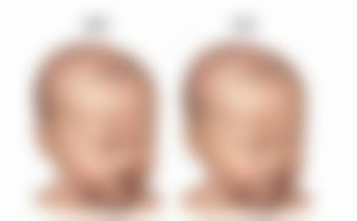 一、刚做完双眼皮能性生活吗?答案及原因