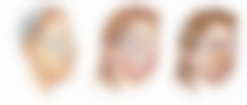 三、刚做完双眼皮术后护理要点