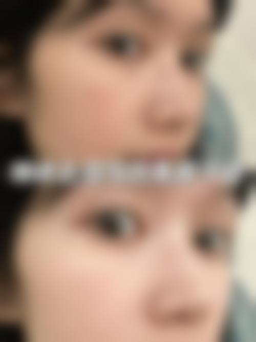 八、温州伊美尔加禾植发诊所真实的患者评价