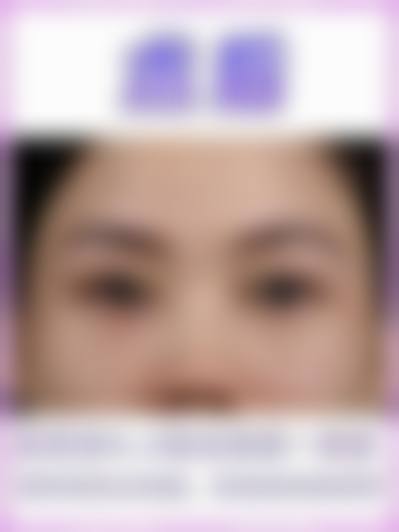 四、温州伊美尔加禾植发诊所特色项目