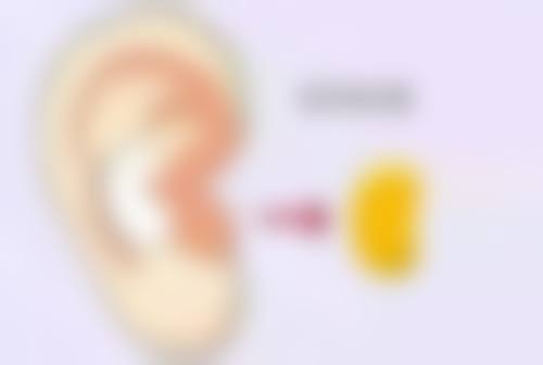 隆鼻一般多久恢复自然？不同隆鼻方式恢复时间大揭秘及注意事项