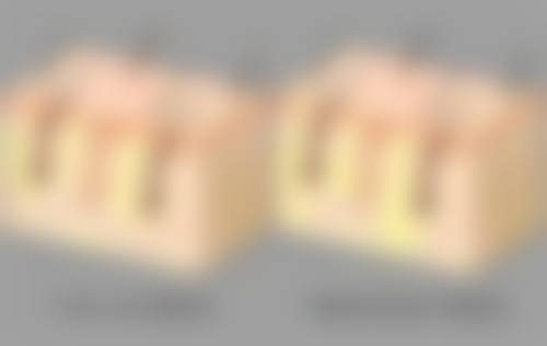 例假期能打瘦脸针吗？专家解析经期打瘦脸针的影响及健康风险