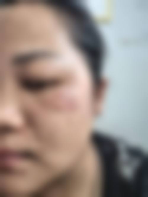 八、沧州圣美医疗美容诊所真实的患者评价