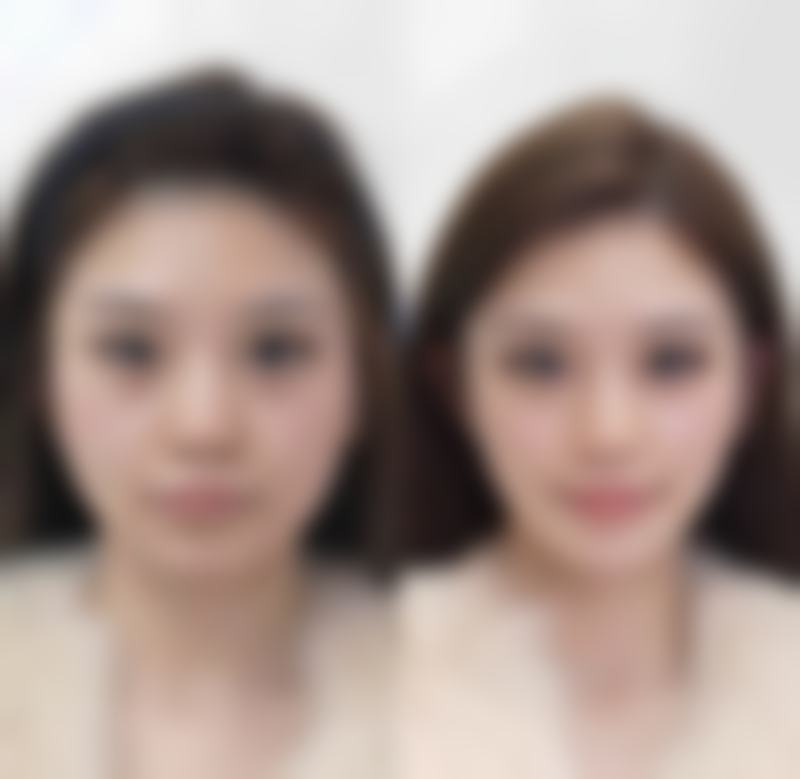六、如何正确使用疤痕膏