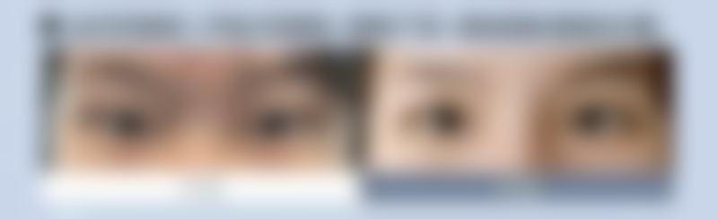 二、呼和浩特伊思医疗美容医院怎么样?