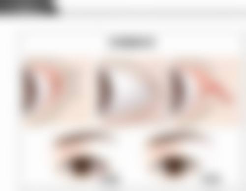 三、如何选择适合的消毒剂