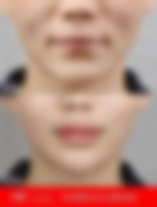 二、徐州市中医院整形美容科怎么样?