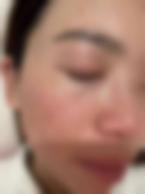 六、姜丽真实的患者评价