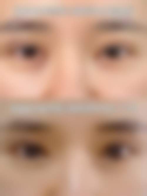 六、朴明旭真实的患者评价