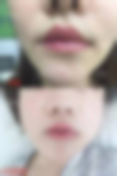六、沈阳新面孔医疗美容诊所价格表