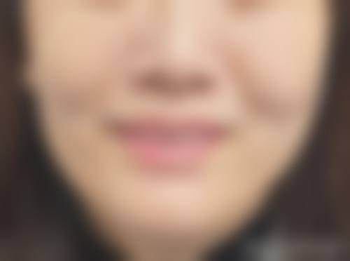 九、济南首美医疗美容门诊部真实的患者评价