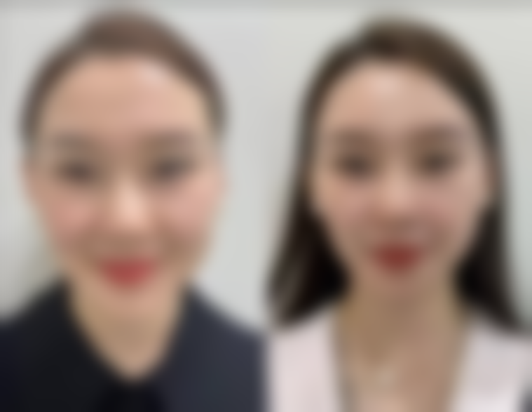 三、疤痕子宫患者的日常管理