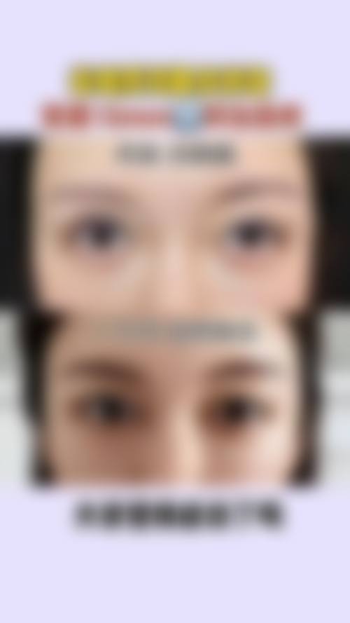 五、武汉市第四 医院整形美容外科价格表