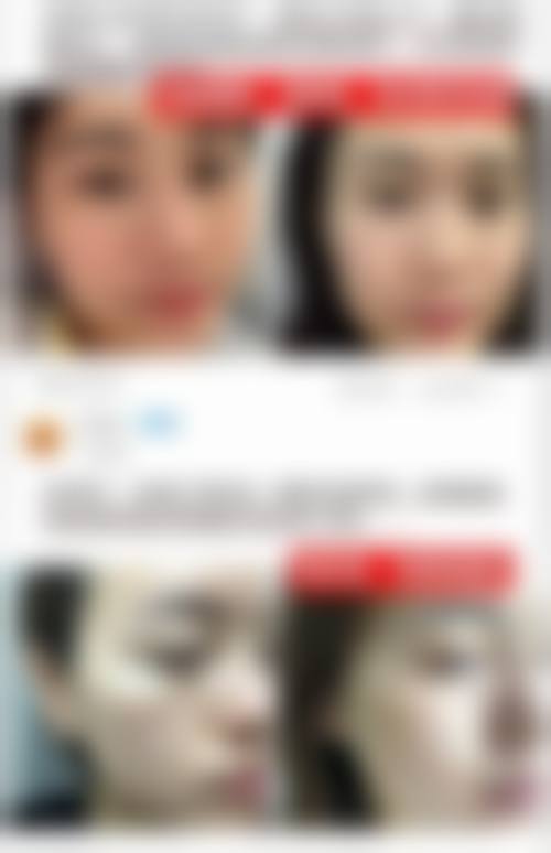 六、童明德真实的患者评价