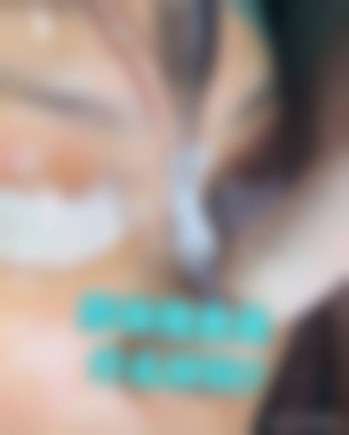 三、武汉克美娜整形医院诊疗项目有哪些？