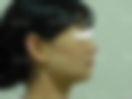七、巴中优肤整形医院预约方式