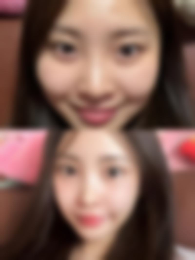 四、武汉克美娜整形医院特色项目