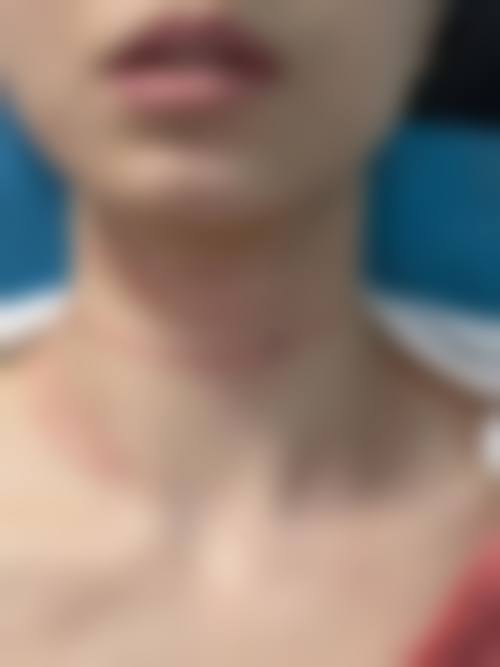 四、圣心美容皮肤科 天神特色项目