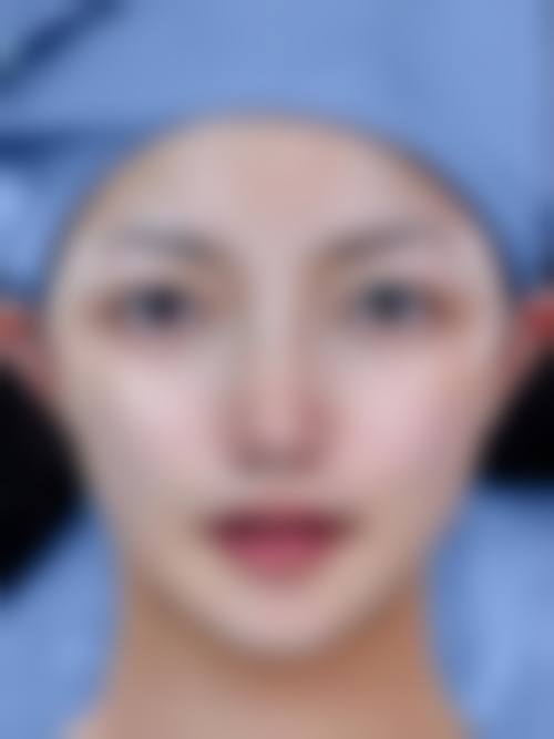四、陕西阿狸佑美医疗美容诊所特色项目