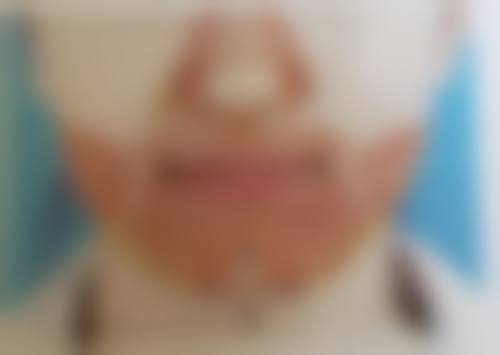 八、陕西阿狸佑美医疗美容诊所预约方式
