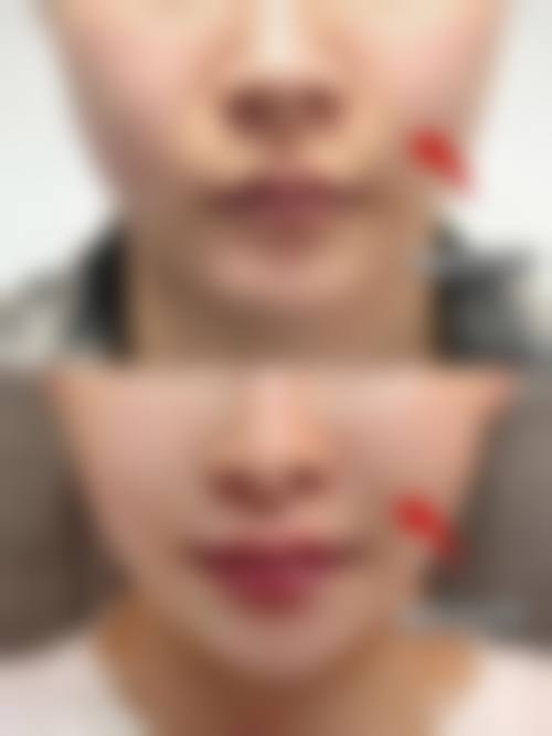 八、圣心美容皮肤科 天神真实的患者评价