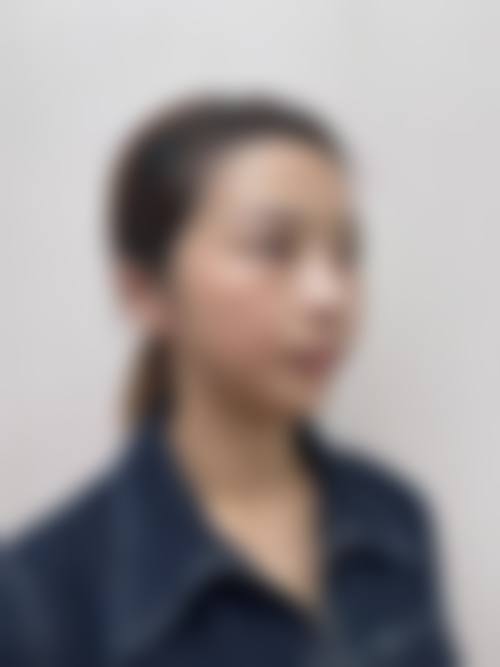 二、陕西阿狸佑美医疗美容诊所怎么样?