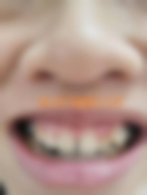 优惠活动详情