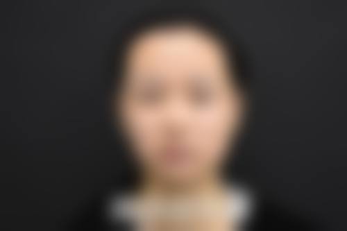 九、韩国BELLAGE抗衰老整形外科真实的患者评价