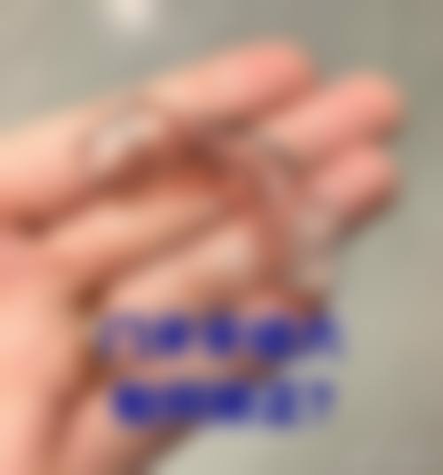 为何选择东莞天健口腔