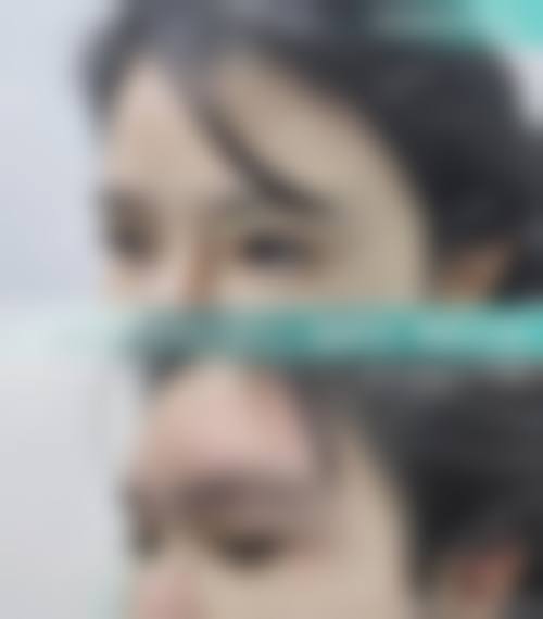 四、抚顺福康皮肤病门诊部特色项目