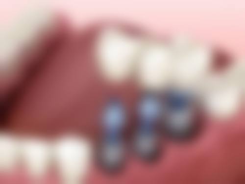 优惠活动详情:享高品质口腔服务
