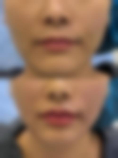 四、南京尚美美容整形医院特色项目