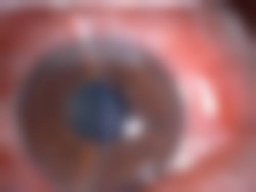 包头市中 心医院眼科:资质与实力保护