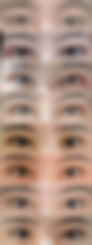 临床实例分享
