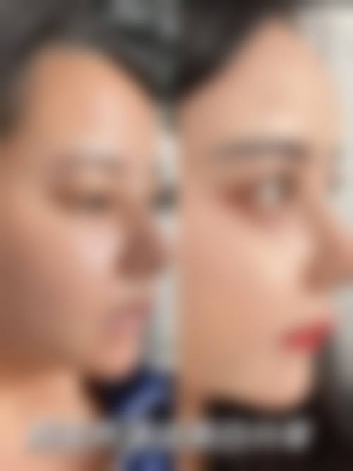优惠活动与预约方式