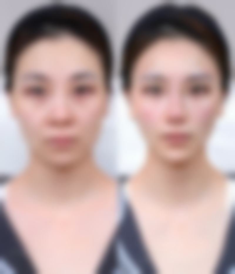总结与预约号召