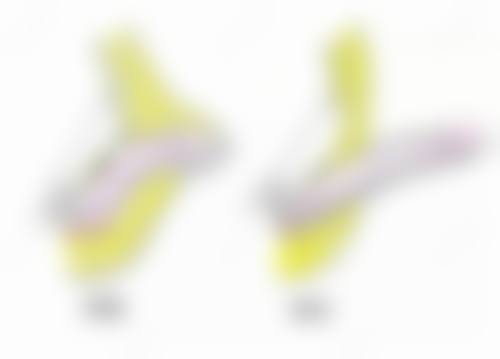 六、出现副作用后的处理办法