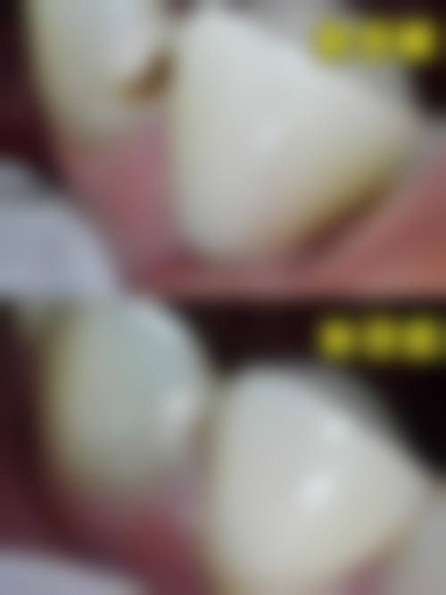 个性化服务与患者保护:从预约到术后全程关怀