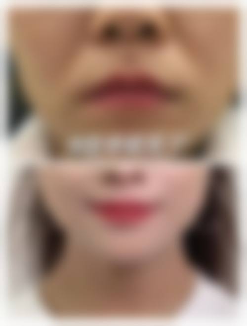 二、哈密火箭农场辛氏中医皮肤医院怎么样?