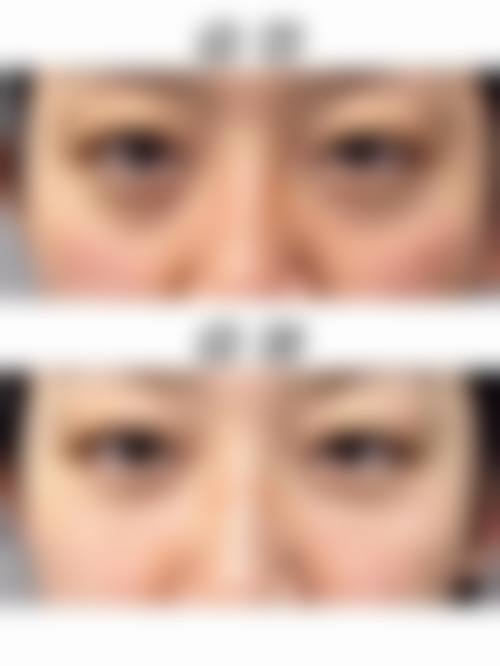 三、邯郸怡婷整形医院诊疗项目有哪些?