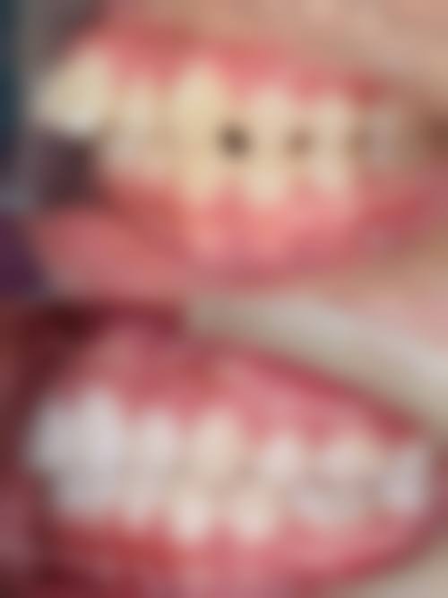 优惠活动详情