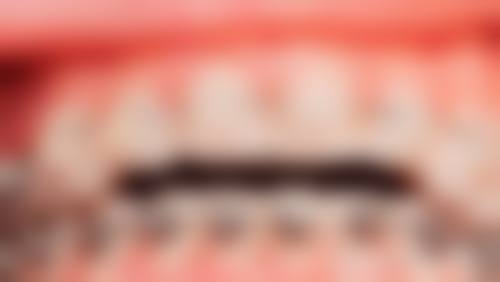 优惠活动详情——双重惊喜,限时预约
