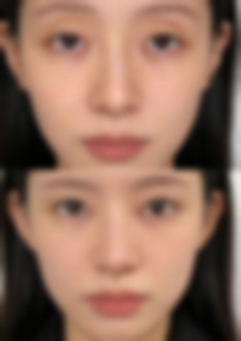 三、柳州爱玛莎整形医院诊疗项目有哪些?