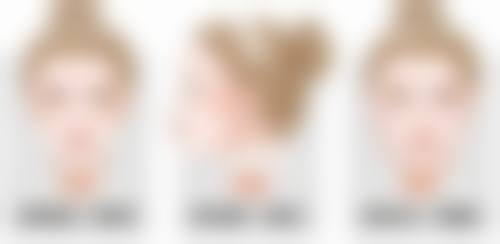 六、总结:割双眼皮能吃蘑菇类吗?