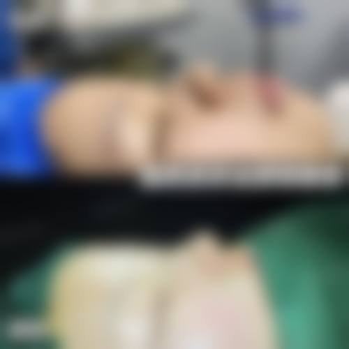 二、鞠光植擅长项目
