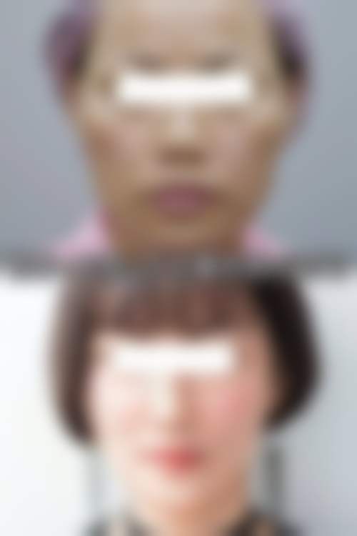 九、新疆四七四 医院整形科真实的患者评价