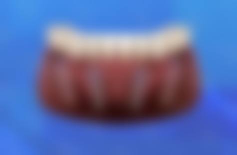 服务流程与患者保护——全程贴心，售后无忧
