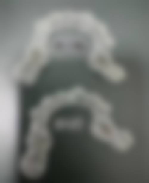 结语:立即预约,开启健康口腔之旅