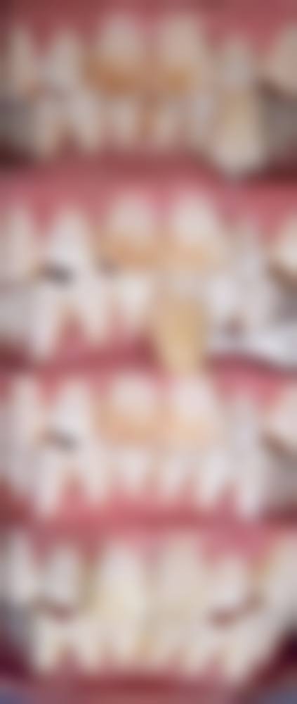 总结:预约便捷,专精矫正值得信赖